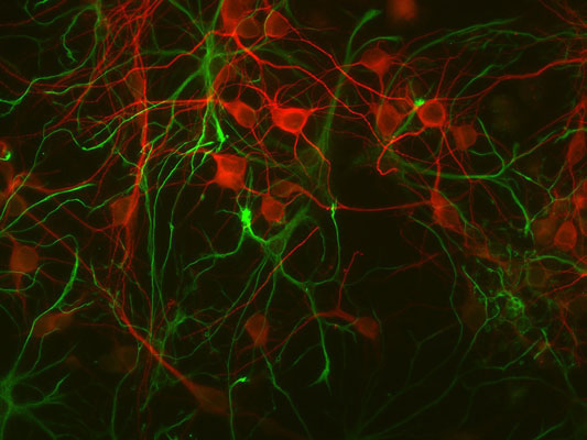 Immunolabeling of mouse cortical cultures labeled with Anti-GFAP 1:1000, green) and anti-MAP2 (1:1000, red).
