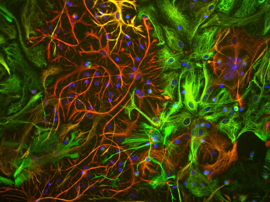 Mixed neuron/glial cultures stained with anti-vimentin (green, 1:500) and rabbit anti-GFAP antibody red, 1:1000). The blue stains nuclear DNA. Vimentin is expressed alone in fibroblastic and endothelial cells, which are the flattened cells in the middle of the image which appear green. Astrocytes may express primarily GFAP, or GFAP and vimentin, and so appear red (GFAP only) or golden yellow (GFAP and Vimentin).
