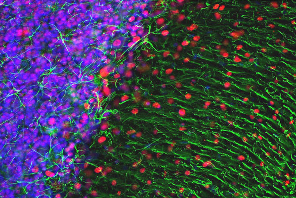 Immunofluorescence of a section of rat cerebellum labeled with anti-GFAP 1:5000,green), colabeled with anti-MeCP2 1:500, red), and DAPI staining of nuclear DNA. The anti-GFAP labels the astrocytic cells and the processes of Bergmann glia in the molecular layer.