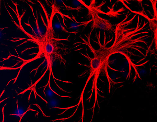 Immunolabeling of mixed neuron and glia cultures where astrocytes are strongly and specifically labeled with Anti-GFAP 1:1000, red), and nuclear staining with DAPI (blue).