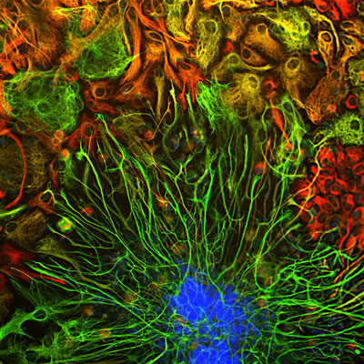 Immunostaining of E20 rat cortical neuron/glial cell culture stained with anti-vimentin red, 1:2000) and anti-GFAP antibody green, 1:5000). The blue is DAPI staining nuclear DNA. Vimentin is expressed alone in fibroblastic and developing cells and appear red. The astrocytes that appear red express only GFAP, while the golden yellow and yellow astrocytes express GFAP and Vimentin.