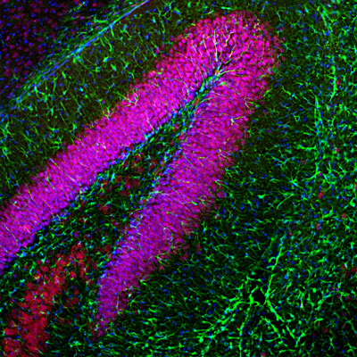 Immunofluorescence of a section of mouse hippocampus colabeled with Anti-GFAP green, 1:5000) and Anti-FOX3 (red). The Anti-FOX3 labels the nuclei and proximal perikarya of neurons while the Anti-GFAP labels a network of astroglial cells. The blue is DAPI staining of nuclear DNA.