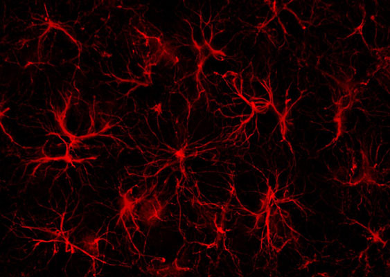 Immunofluorescence of a section of mouse prefrontal cortex labeled with Anti-GFAP red, 1:1000). Image courtesy Andrea Cardenas, Rosalind Franklin Unversity, Medicine and Science.
