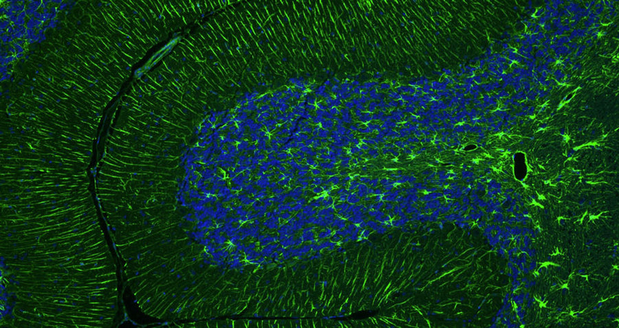 Guinea Pig Anti-GFAP (Recombinant Chimeric)