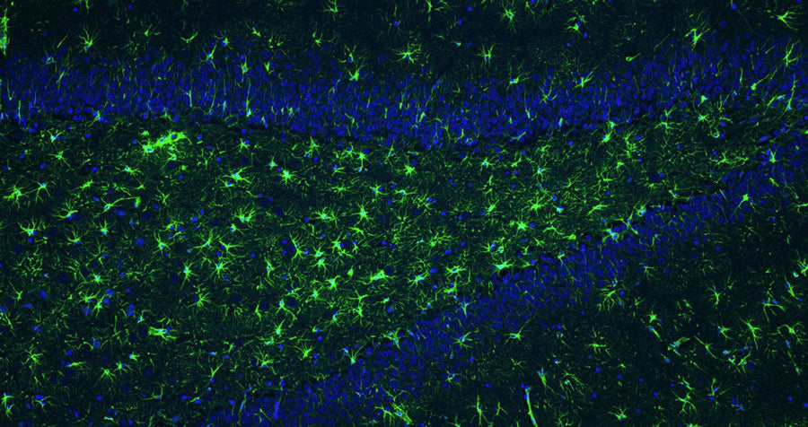 Guinea Pig Anti-GFAP (Recombinant Chimeric)