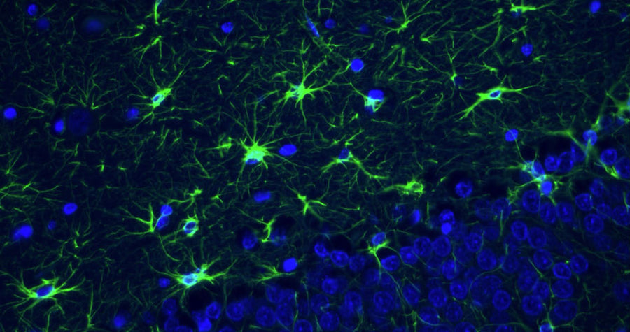 Guinea Pig Anti-GFAP (Recombinant Chimeric)