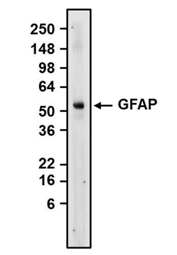 Guinea Pig Anti-GFAP (Recombinant Chimeric)