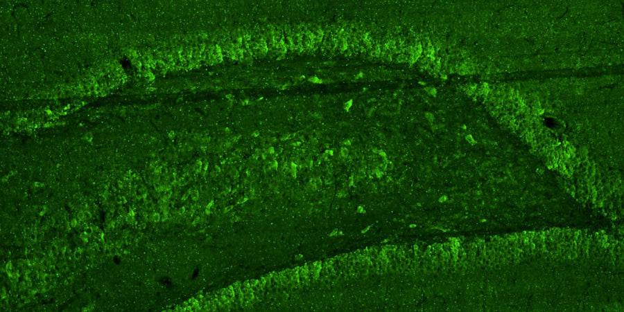 Representative section of formalin fixed, paraffin-embedded rat brain hippocampal region showing cells stained by anti-GluA2/GluR2 Glutamate Receptor recombinant chicken mAb (green) using goat anti-chicken IgY CF®488 secondary antibody.