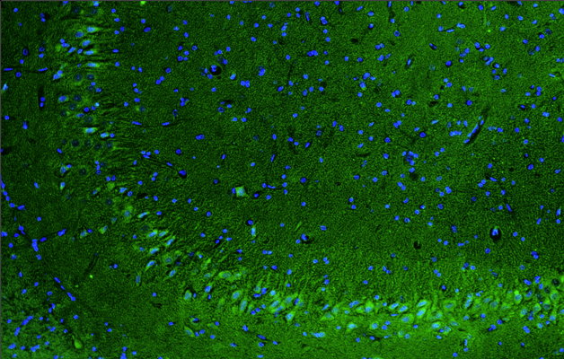 Representative section of formalin fixed, paraffin-embedded rat brain hippocampal CA2/CA3 region showing cells stained by anti-Nav1.1 (SCN1A) antibody using goat anti-chicken IgY CF®488 secondary antibody (visualized in green). DAPI nuclear stain (blue) shows cell nuclei.