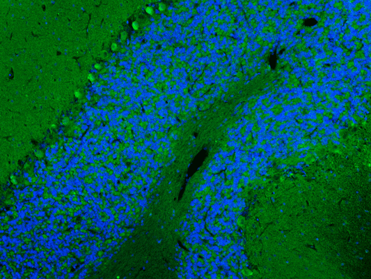 Representative section of formalin fixed, paraffin-embedded rat brain cerebellum region showing cells stained by anti-Nav1.1 (SCN1A) antibody using goat anti-chicken IgY CF®488 secondary antibody (visualized in green). DAPI nuclear stain (blue) shows cell nuclei.