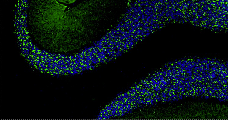 Formalin fixed, paraffin-embedded rat brain cerebellum region showing staining of PSD-95. The sections were stained with anti-PSD-95 recombinant chicken monoclonal antibody (green) at 1:500 dilution. DAPI nuclear stain (blue) shows cell nuclei. Anti-PSD-95 specifically stains the excitatory synapses in the granular layer of the cerebellum. Magnification 100X.