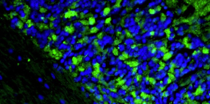 Formalin fixed, paraffin-embedded rat brain cerebellum region showing staining of PSD-95. The sections were stained with anti-PSD-95 recombinant chicken monoclonal antibody (green) at 1:500 dilution. DAPI nuclear stain (blue) shows cell nuclei. Anti-PSD-95 specifically stains the excitatory synapses in the granular layer of the cerebellum. Magnification 400X.