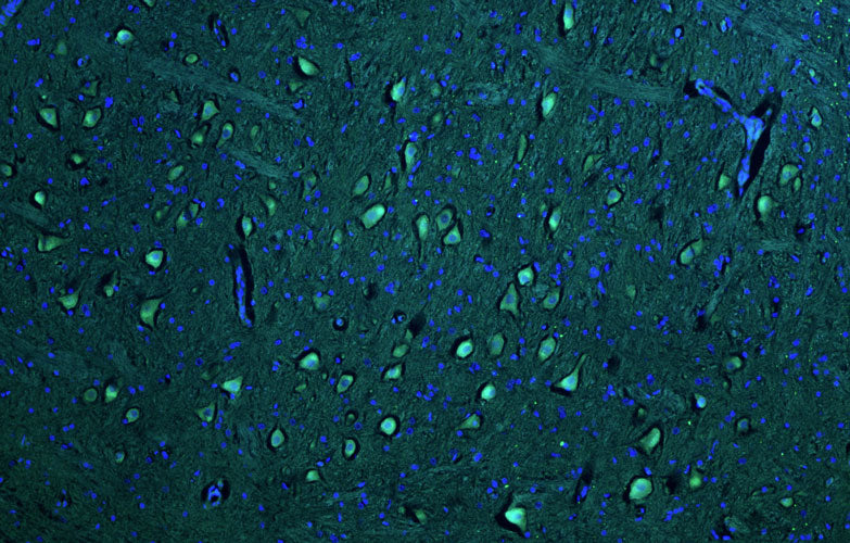 Representative section of formalin fixed, paraffin-embedded rat brain stem neurons stained by anti-PTEN Induced Putative Kinase 1 (PINK1) recombinant chicken monoclonal antibody using goat anti-chicken IgY CF®488 secondary antibody (visualized in green). DAPI nuclear stain (blue) shows cell nuclei.