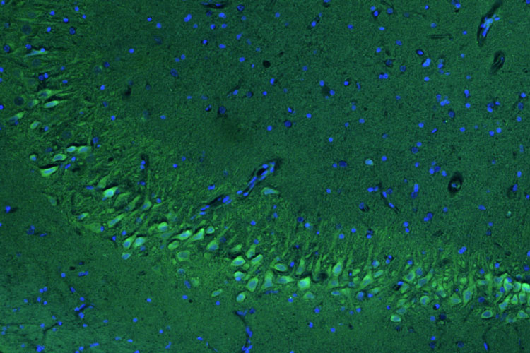 Representative section of formalin fixed, paraffin-embedded rat brain hippocampus stained by anti-PTEN Induced Putative Kinase 1 (PINK1) recombinant chicken monoclonal antibody using goat anti-chicken IgY CF®488 secondary antibody (visualized in green). DAPI nuclear stain (blue) shows cell nuclei.