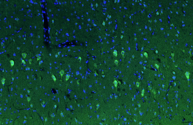Representative section of formalin fixed, paraffin-embedded rat brain cortex stained by anti-PTEN Induced Putative Kinase 1 (PINK1) recombinant chicken monoclonal antibody using goat anti-chicken IgY CF®488 secondary antibody (visualized in green). DAPI nuclear stain (blue) shows cell nuclei.