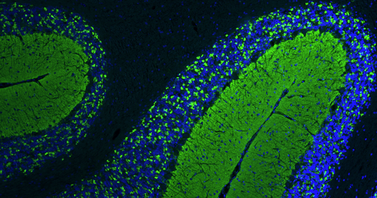 Formalin fixed, paraffin-embedded rat brain cerebellum region showing staining of VGlut1. The sections were stained with anti-VGlut1 recombinant chicken monoclonal antibody (green) at 1:100 dilution. DAPI nuclear stain (blue) shows cell nuclei. Anti-VGlut1 specifically stains the axonal synapses in the granular layer of the cerebellum. Magnification 100X.
