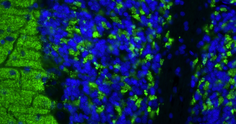 Formalin fixed, paraffin-embedded rat brain cerebellum region showing staining of VGlut1. The sections were stained with anti-VGlut1 recombinant chicken monoclonal antibody (green) at 1:100 dilution. DAPI nuclear stain (blue) shows cell nuclei. Anti-VGlut1 specifically stains the axonal synapses in the granular layer of the cerebellum. Magnification 400X.