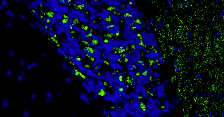 Formalin fixed, paraffin-embedded rat brain cerebellum region showing staining of VGlut2 with anti-VGlut2 recombinant chicken monoclonal antibody (green) at 1:100 dilution. The sections were mounted with Fluoroshield with DAPI and DABCO mounting medium. DAPI nuclear stain (blue) shows cell nuclei. Anti-VGlut2 specifically stains the mossy fiber terminals in the granular layer and climbing fiber terminals in the molecular layer of the cerebellum. Magnification 400X.