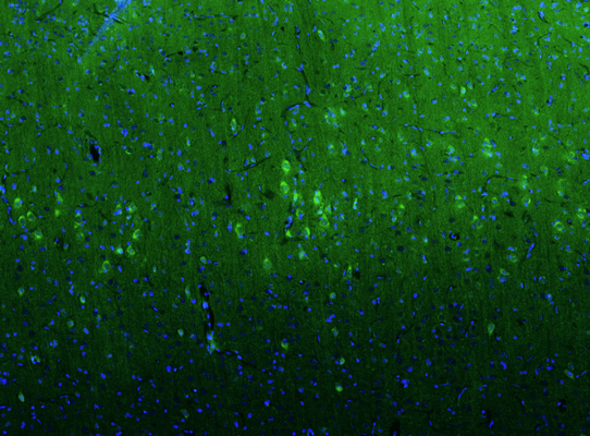 Representative section of formalin fixed, paraffin-embedded rat brain cerebral cortex stained by anti-GluN2B recombinant chicken monoclonal antibody using goat anti-chicken IgY CF®488 secondary antibody (visualized in green). DAPI nuclear stain (blue) shows cell nuclei. Anti-GluN2B specifically stains the neurons in layers II/III of the cerebral cortex.