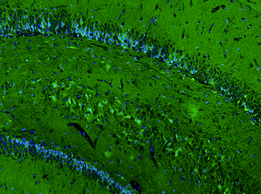 Representative section of formalin fixed, paraffin-embedded rat brain hippocampus showing neurons in CA4 region stained by anti-GluN2B recombinant chicken monoclonal antibody using goat anti-chicken IgY CF®488 secondary antibody (visualized in green). DAPI nuclear stain (blue) shows cell nuclei.