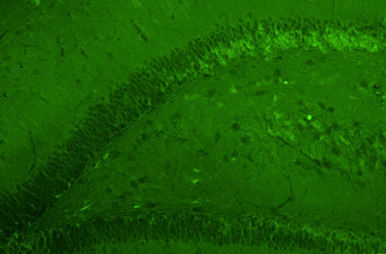 Representative section of formalin fixed, paraffin-embedded rat brain hippocampal dentate gyrus region showing cells stained by anti-GluN2B/NR2B Glutamate Receptor recombinant chicken mAb (green) using goat anti-chicken IgY CF®488 secondary antibody.