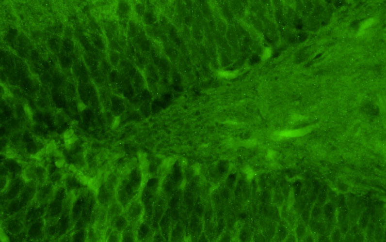 Representative section of formalin fixed, paraffin-embedded rat brain hippocampal dentate gyrus region showing cells stained by anti-GluN2B/NR2B Glutamate Receptor recombinant chicken mAb (green) using goat anti-chicken IgY CF®488 secondary antibody.