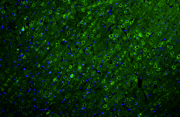 Representative section of formalin fixed, paraffin-embedded rat brain cerebral cortex showing neurons stained by Ankyrin-G (ANK3) recombinant chicken monoclonal antibody (visualized in green). DAPI nuclear stain (blue) shows cell nuclei. Anti-Ankyrin-G specifically stains the neuronal cell body and axon initial segment (AIS) in the cerebral cortex. Mag. 100X.