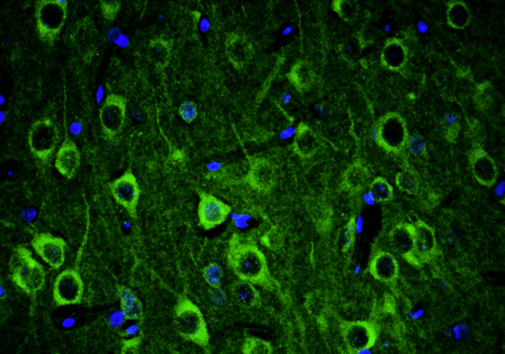 Representative section of formalin fixed, paraffin-embedded rat brain cerebral cortex showing neurons stained by Ankyrin-G (ANK3) recombinant chicken monoclonal antibody (visualized in green). DAPI nuclear stain (blue) shows cell nuclei. Anti-Ankyrin-G specifically stains the neuronal cell body and axon initial segment (AIS) in the cerebral cortex. Mag. 400X.