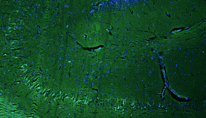 Representative section of formalin fixed, paraffin-embedded rat brain hippocampus region showing cells stained with anti-RGS14 recombinant chicken monoclonal antibody using goat anti-chicken IgY CF®488 secondary antibody (green). The stained sections were mounted with Fluoroshield with DAPI and DABCO mounting medium. DAPI nuclear stain (blue) shows cell nuclei. Anti-RGS14 specifically stains the pyramidal neurons in the CA2 region of the hippocampus.
