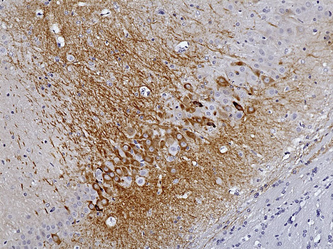 Representative image of 4% paraformaldehyde fixed free-floating rat brain sections stained with anti-RGS14 recombinant chicken monoclonal antibody (brown) at 1:1000 dilution. Anti-RGS14 stains specific neurons and processes in the rat frontal cortex. Magnification 200X.