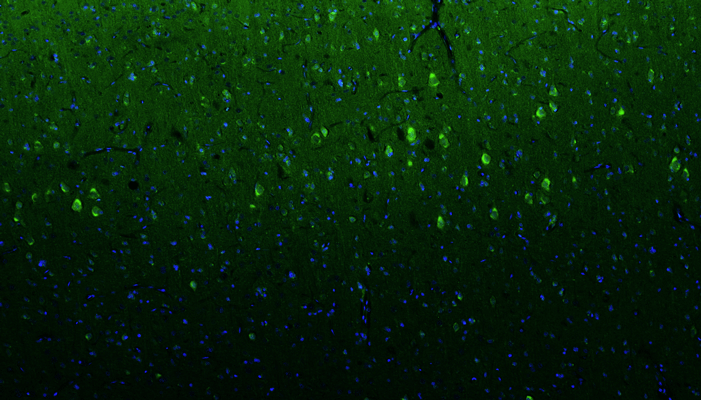 Formalin fixed, paraffin-embedded rat brain cerebral cortex showing oligodendocytes stained by Olig1 recombinant chicken monoclonal antibody using goat anti-chicken IgY CF®488 secondary antibody (visualized in green). DAPI nuclear stain (blue) shows cell nuclei. Anti-Olig1 specifically stains the oligodendrocytes in the cerebral cortex.