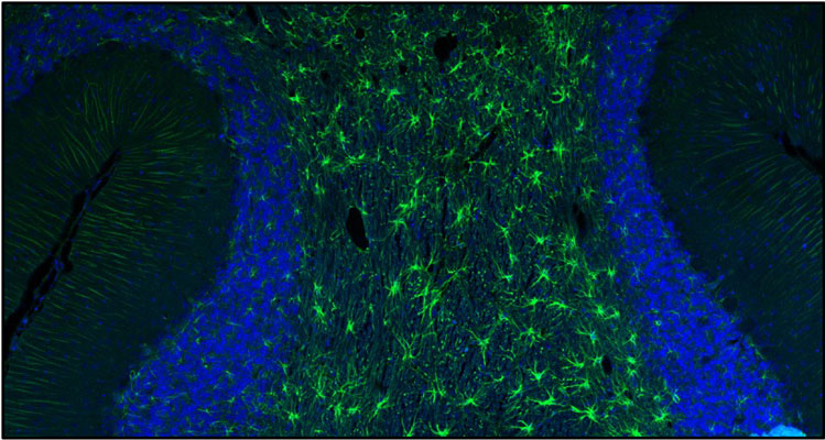 DAPI nuclear stain (blue) shows cell nuclei. Anti-GFAP specifically stains the astrocytes in the rat brain. Magnification 100X.