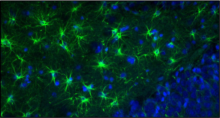 Representative section of formalin fixed, paraffin-embedded rat brain showing staining of GFAP. DAPI nuclear stain (blue) shows cell nuclei. Anti-GFAP specifically stains the astrocytes in the rat brain. Magnification 400X.