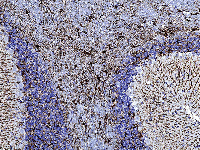 Anti-GFAP specifically stains the astrocytes in the rat brain. Magnification 200X.