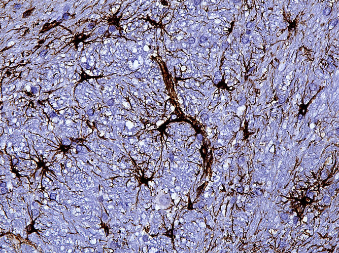 Anti-GFAP specifically stains the astrocytes in the rat brain. Magnification 400X.