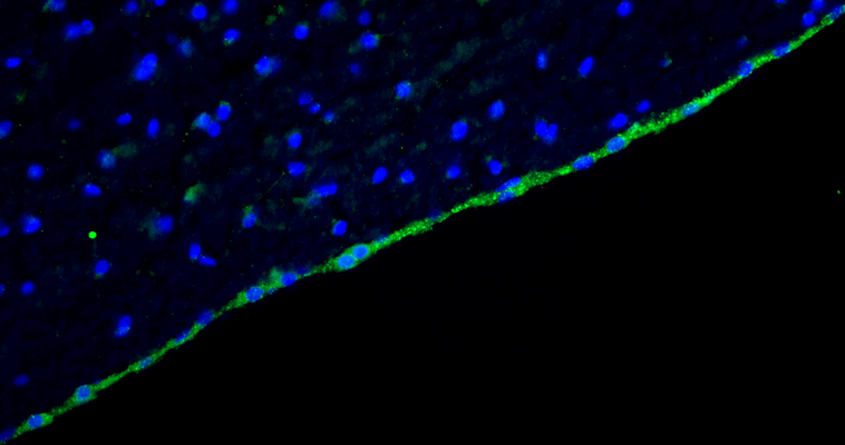 Representative section of formalin fixed, paraffin-embedded rat brain lateral ventricle region showing cells stained by anti-Arl13b recombinant antibody (visualized in green) at 1:100 dilution. DAPI nuclear stain (blue) shows cell nuclei. Anti-Arl13b specifically stains the ciliated cells surrounding the lateral ventricle. Magnification 400X.
