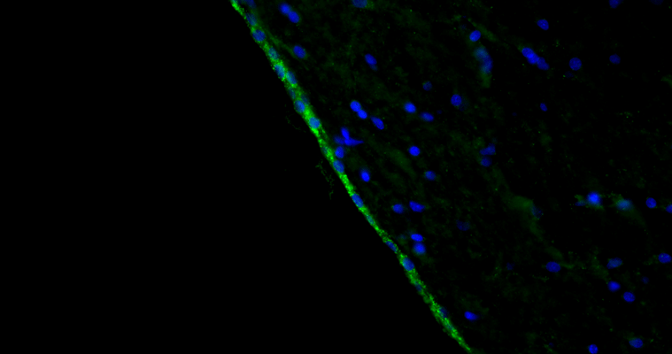 Representative section of formalin fixed, paraffin-embedded rat brain lateral ventricle region showing cells stained by anti-Arl13b recombinant antibody (visualized in green) at 1:100 dilution. DAPI nuclear stain (blue) shows cell nuclei. Anti-Arl13b specifically stains the ciliated cells surrounding the lateral ventricle. Magnification 400X.