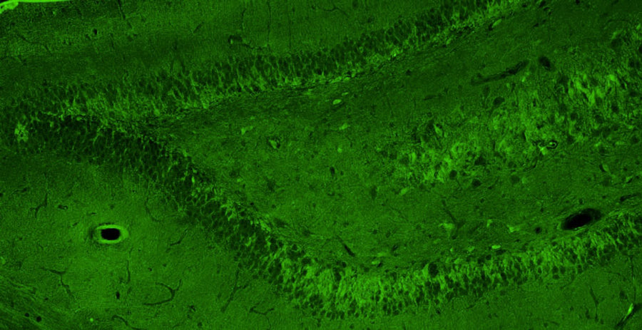 Representative section of formalin fixed, paraffin-embedded rat brain hippocampus showing cells stained by anti-GluN2A/NR2A Glutamate Receptor recombinant chicken mAb (green) using goat anti-chicken IgY CF®488 secondary antibody.