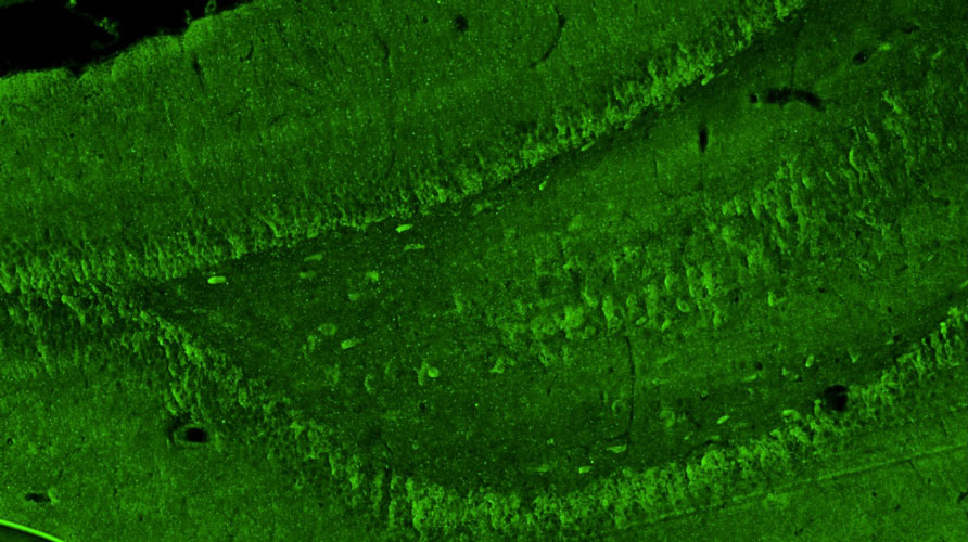Representative section of formalin fixed, paraffin-embedded rat brain hippocampal region showing cells stained by anti-GluA1/GluR1 Glutamate Receptor recombinant chicken mAb (green) antibody using goat anti-chicken IgY CF®488 secondary antibody.