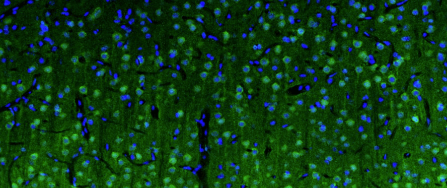 Representative section of formalin fixed, paraffin-embedded rat brain cerebral cortex showing cells stained by anti-Beta4 Spectrin recombinant chicken monoclonal antibody (green). DAPI nuclear stain (blue) shows cell nuclei. Anti-Beta4 Spectrin specifically stains the neuronal body and axon initial segment (AIS) in the cerebral cortex. Magnification 100X.