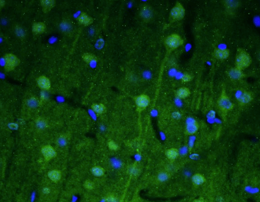 Representative section of formalin fixed, paraffin-embedded rat brain cerebral cortex showing cells stained by anti-Beta4 Spectrin recombinant chicken monoclonal antibody (green). DAPI nuclear stain (blue) shows cell nuclei. Anti-Beta4 Spectrin specifically stains the neuronal body and axon initial segment (AIS) in the cerebral cortex. Magnification 400X.