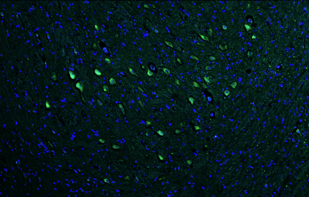 Representative section of formalin fixed, paraffin-embedded rat brain stem showing facial motor neurons stained by VAChT (Slc18a3) recombinant chicken monoclonal antibody using goat anti-chicken IgY CF®488 secondary antibody (green). DAPI nuclear stain (blue) shows cell nuclei.