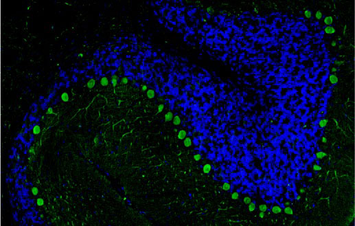 DAPI nuclear stain (blue) shows cell nuclei. Anti-CALB1 specifically stains the Purkinje cells in the cerebellum. Magnification 100X.