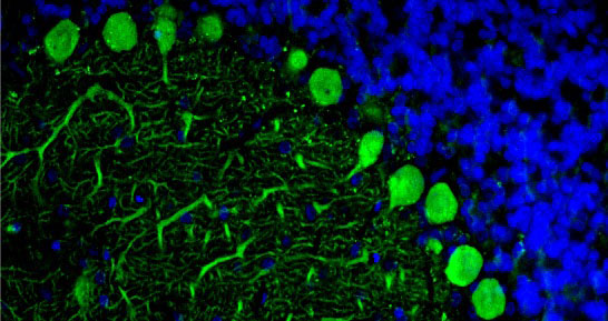 DAPI nuclear stain (blue) shows cell nuclei. Anti-CALB1 specifically stains the Purkinje cells in the cerebellum. Magnification 400X.