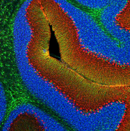 DAPI nuclear stain (blue) shows cell nuclei. Anti-CALB1 specifically stains the Purkinje cells in the cerebellum.