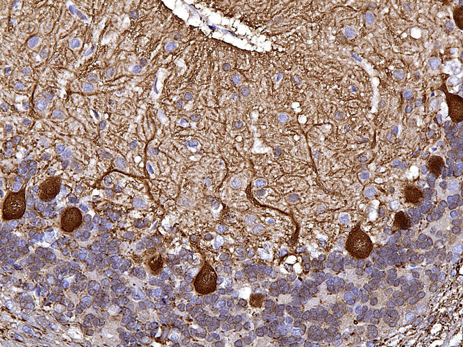 Anti-CALB1 specifically stains the Purkinje cells in the cerebellum. Magnification 400X.