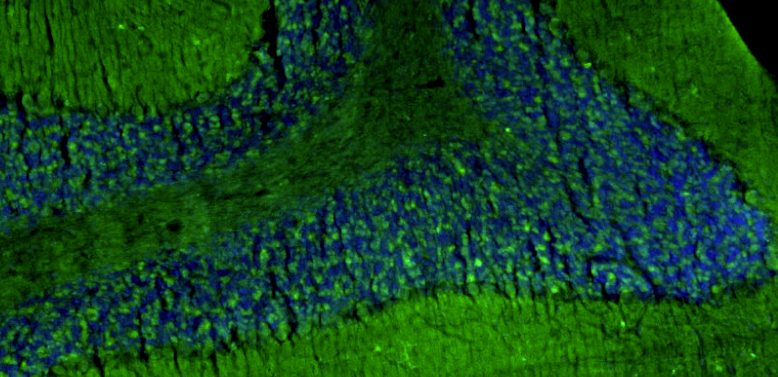 Representative section of formalin fixed, paraffin-embedded rat brain cerebellum region showing staining of Homer1 with anti-Homer1 recombinant chicken monoclonal antibody (green) at 1:100 dilution. The stained sections were mounted with Fluoroshield with DAPI and DABCO mounting medium. DAPI nuclear stain (blue) shows cell nuclei. Anti-Homer1 stains the postsynaptic densities of the Purkinje cell dendrites in the molecular layer of the cerebellum. Magnification 100X.