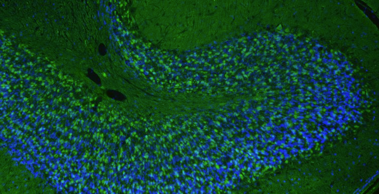 Representative FFPE section of rat brain cerebellum showing Homer1 staining. The sections were stained with anti-Homer1 recombinant chicken mAb using goat anti-chicken IgY FITC secondary antibody (green). The stained sections were mounted with Fluoroshield (DAPI & DABCO) mounting medium. DAPI (blue) stains cell nuclei. Anti-Homer1 stains the postsynaptic densities of the Purkinje cell dendrites in the molecular layer of the cerebellum.