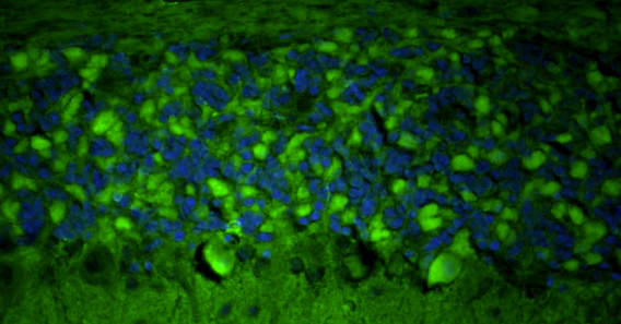 Representative FFPE section of rat brain cerebellum showing Homer1 staining. The sections were stained with anti-Homer1 recombinant chicken mAb using goat anti-chicken IgY FITC secondary antibody (green). The stained sections were mounted with Fluoroshield (DAPI & DABCO) mounting medium. DAPI (blue) stains cell nuclei. Anti-Homer1 stains the postsynaptic densities of the Purkinje cell dendrites in the molecular layer of the cerebellum.
