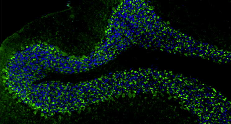 Representative FFPE section of rat brain cerebellum showing VGAT staining. The sections were stained with anti-VGAT recombinant chicken monoclonal antibody using goat anti-chicken IgY FITC secondary antibody (green). The stained sections were mounted with Fluoroshield (DAPI and DABCO) mounting medium. DAPI (blue) stains cell nuclei. Anti-VGAT stains the GABAergic terminals and neurons in the cerebellum. Magnification 100X.